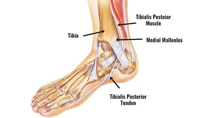 Ankle Tendon overload