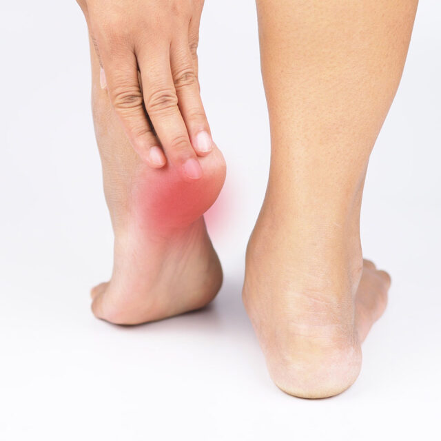 Treatment Plantar Fasciitis