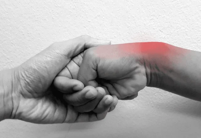 De Quervain's Tenosynovitis Ultrasound