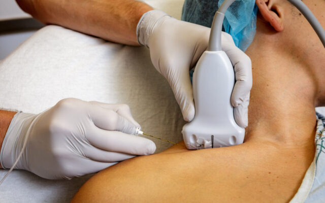 Long Term Pain Procedures Injuries